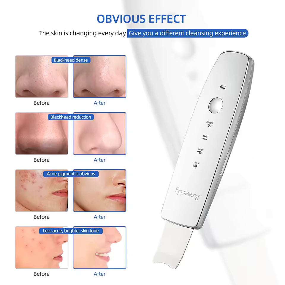 6 in 1 EMS Ultrasonic Skin Scrubber & LED Facial Massager