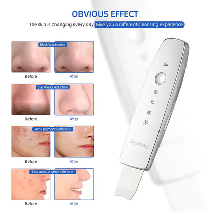 6 in 1 EMS Ultrasonic Skin Scrubber & LED Facial Massager