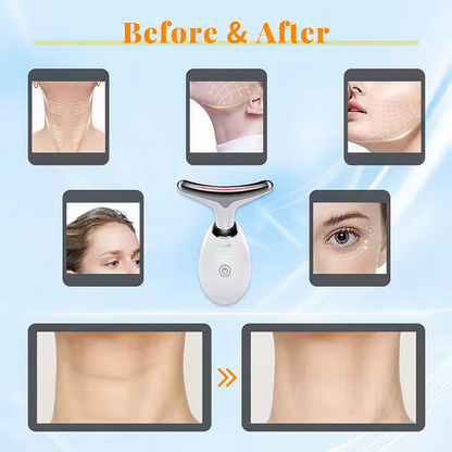 7 Colors LED Neck & Face Lifting Device – Skin Tightening & Wrinkle Remover Massager